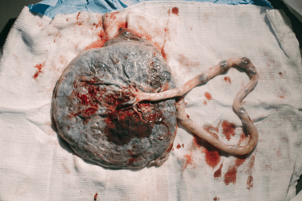 placenta